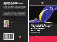 Buchcover von Segmentação de vasos sanguíneos da retina utilizando redes neuronais