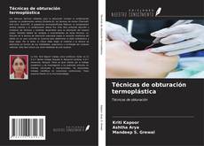 Bookcover of Técnicas de obturación termoplástica