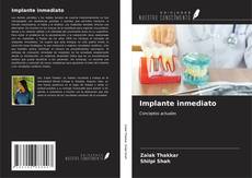 Bookcover of Implante inmediato