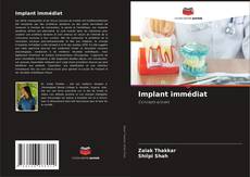 Bookcover of Implant immédiat