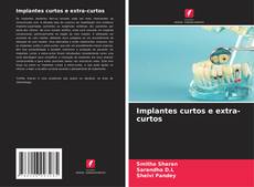 Bookcover of Implantes curtos e extra-curtos