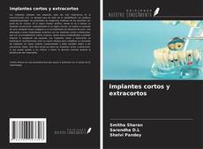 Bookcover of Implantes cortos y extracortos