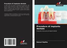 Buchcover von Procedure di impianto dentale