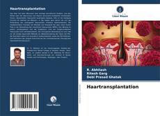 Haartransplantation kitap kapağı
