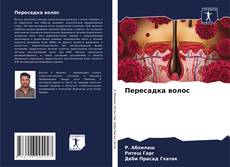 Bookcover of Пересадка волос