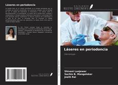 Bookcover of Láseres en periodoncia
