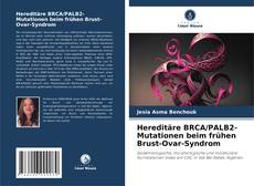 Capa do livro de Hereditäre BRCA/PALB2-Mutationen beim frühen Brust-Ovar-Syndrom 