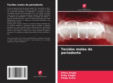 Capa do livro de Tecidos moles do periodonto 
