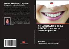 Buchcover von RÉHABILITATION DE LA BOUCHE: L'approche interdisciplinaire