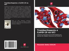 Buchcover von Trombocitopenia e CoViD-19 na UCI