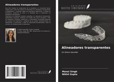 Buchcover von Alineadores transparentes