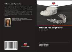 Bookcover of Effacer les aligneurs