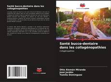 Capa do livro de Santé bucco-dentaire dans les collagénopathies 