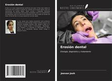 Capa do livro de Erosión dental 