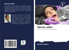 Bookcover of Эрозия зубов