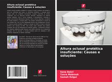 Bookcover of Altura oclusal protética insuficiente: Causas e soluções
