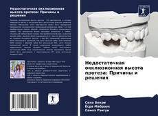Bookcover of Недостаточная окклюзионная высота протеза: Причины и решения