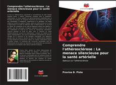 Bookcover of Comprendre l'athérosclérose : La menace silencieuse pour la santé artérielle