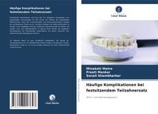 Portada del libro de Häufige Komplikationen bei festsitzendem Teilzahnersatz