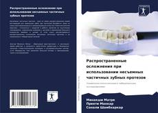 Buchcover von Распространенные осложнения при использовании несъемных частичных зубных протезов