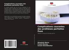 Buchcover von Complications courantes des prothèses partielles fixes