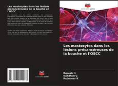 Bookcover of Les mastocytes dans les lésions précancéreuses de la bouche et l'OSCC