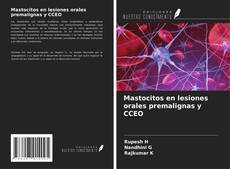 Bookcover of Mastocitos en lesiones orales premalignas y CCEO