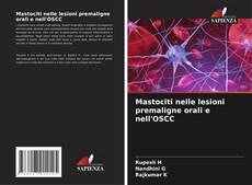 Bookcover of Mastociti nelle lesioni premaligne orali e nell'OSCC