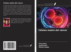 Copertina di Células madre del cáncer