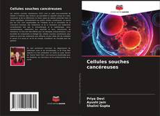 Bookcover of Cellules souches cancéreuses