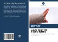 Bookcover of AKUTE SCHWERE BRONCHIOLITIS
