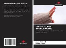 Bookcover of SEVERE ACUTE BRONCHIOLITIS