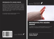 Bookcover of BRONQUIOLITIS AGUDA GRAVE
