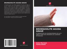BRONQUIOLITE AGUDA GRAVE kitap kapağı