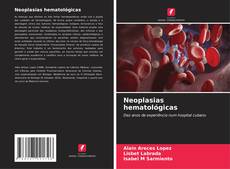 Bookcover of Neoplasias hematológicas