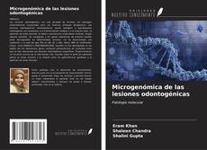 Bookcover of Microgenómica de las lesiones odontogénicas