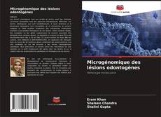 Buchcover von Microgénomique des lésions odontogènes