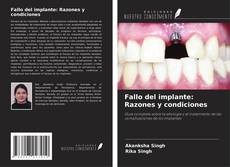 Couverture de Fallo del implante: Razones y condiciones