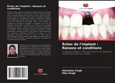 Copertina di Échec de l'implant : Raisons et conditions