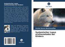 Buchcover von Systemischer Lupus erythematodes bei Kindern