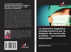Buchcover von La risonanza magnetica multiparametrica per la diagnosi del cancro alla prostata - una revisione sistematica