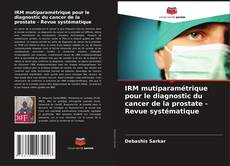 IRM mutiparamétrique pour le diagnostic du cancer de la prostate - Revue systématique kitap kapağı