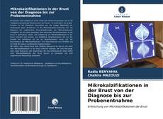 Capa do livro de Mikrokalzifikationen in der Brust von der Diagnose bis zur Probenentnahme 