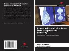 Capa do livro de Breast microcalcifications: from diagnosis to sampling 