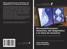 Capa do livro de Microcalcificaciones mamarias, del diagnóstico a la toma de muestras 
