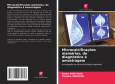 Capa do livro de Microcalcificações mamárias, do diagnóstico à amostragem 