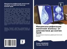 Buchcover von Микрокальцификации молочной железы: от диагностики до взятия проб