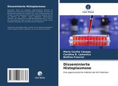 Disseminierte Histoplasmose kitap kapağı
