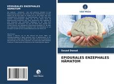 Capa do livro de EPIDURALES ENZEPHALES HÄMATOM 