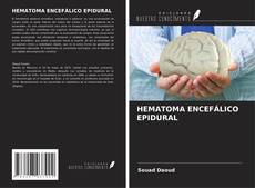 Buchcover von HEMATOMA ENCEFÁLICO EPIDURAL